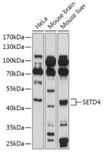 Western blot analysis of extracts of various cell lines, using Anti-SETD4 Antibody (A309229) at 1:1,000 dilution. The secondary antibody was Goat Anti-Rabbit IgG H&L Antibody (HRP) at 1:10,000 dilution.