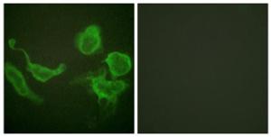 Immunofluorescence analysis of HeLa cells using Anti-KCNC4 Antibody. The right hand panel represents a negative control, where the antibody was pre-incubated with the immunising peptide