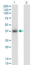 Anti-GPD1 Mouse Monoclonal Antibody [clone: 3C10-1C4]