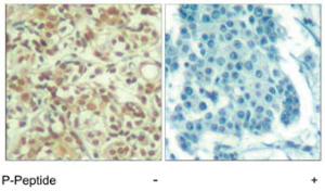 Anti-AKT1 Rabbit Polyclonal Antibody