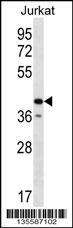 Anti-GORASP2 Rabbit Polyclonal Antibody (APC (Allophycocyanin))