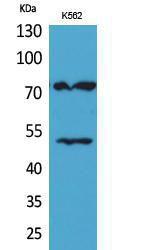 Anti-HDC antibody