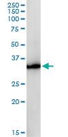 Anti-GPD1 Mouse Monoclonal Antibody [clone: 3C10-1C4]