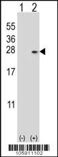 Anti-DUSP14 Rabbit Polyclonal Antibody (PE (Phycoerythrin))