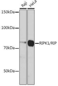 Western blot analysis of extracts of various cell lines, using Anti-RIP Antibody [ARC0059] (A309230) at 1:1,000 dilution. The secondary antibody was Goat Anti-Rabbit IgG H&L Antibody (HRP) at 1:10,000 dilution.