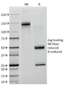 SDS-PAGE analysis of Anti-Lambda Light Chain Antibody [ICO-106] under non-reduced and reduced conditions; showing intact IgG and intact heavy and light chains, respectively SDS-PAGE analysis confirms the integrity and purity of the antibody