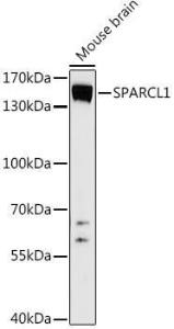 Western blot analysis of extracts of Mouse brain, using Anti-SPARCL1 Antibody (A306325) at 1:1,000 dilution. The secondary antibody was Goat Anti-Rabbit IgG H&L Antibody (HRP) at 1:10,000 dilution.