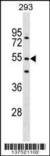 Anti-FBXW9 Rabbit Polyclonal Antibody