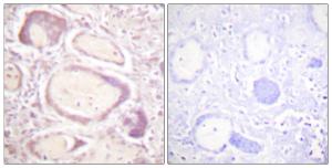 Immunohistochemical analysis of paraffin-embedded human placenta using Anti-Cyclin B1 (phospho Ser147) Antibody The right hand panel represents a negative control, where the antibody was pre-incubated with the immunising peptide