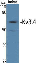 Western blot analysis of various cells using Anti-KCNC4 Antibody