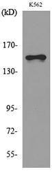 Anti-LAMC2 antibody