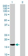 Anti-HSPB7 Mouse Polyclonal Antibody