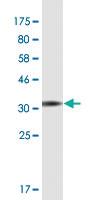 Anti-TCIRG1 Mouse Monoclonal Antibody [clone: 7H20]