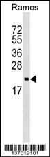 Anti-ARF5 Rabbit Polyclonal Antibody (PE (Phycoerythrin))