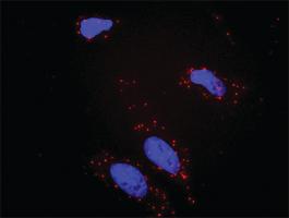 Anti-BCR + PIK3CG Antibody Pair