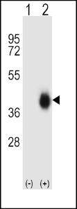 Anti-FCAR Rabbit Polyclonal Antibody (Biotin)