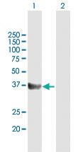 Anti-CD5L Mouse Polyclonal Antibody