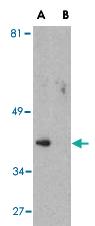 Anti-PTEN Rabbit Polyclonal Antibody