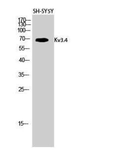 Western blot analysis of SH SY5Y cells using Anti-KCNC4 Antibody