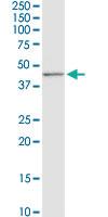 Anti-CD5L Rabbit Polyclonal Antibody