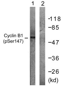 Western blot analysis of lysates from Jurkat cells treated with UV 15' using Anti-Cyclin B1 (phospho Ser147) Antibody The right hand lane represents a negative control, where the antibody is blocked by the immunising peptide