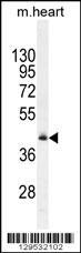 Anti-RMD1 Rabbit Polyclonal Antibody (Biotin)