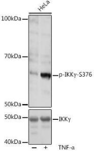 Western blot analysis of extracts of HeLa cells, using Anti-IKK gamma / NEMO (phospho Ser376) Antibody (A309231) at 1:1,000 dilution or IKKgamma antibody (A0917