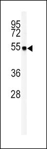 Anti-GOT1 Rabbit Polyclonal Antibody (FITC (Fluorescein Isothiocyanate))