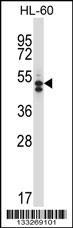 Anti-HDAC7 Rabbit Polyclonal Antibody