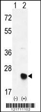 Anti-MSRB2 Rabbit Polyclonal Antibody (APC (Allophycocyanin))