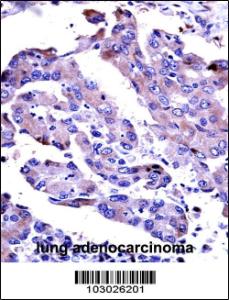 Anti-AKT2 Rabbit Polyclonal Antibody (HRP (Horseradish Peroxidase))