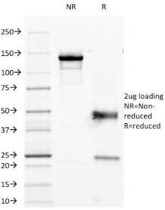 SDS-PAGE analysis of Anti-CD45RO Antibody [190-2F25] under non-reduced and reduced conditions; showing intact IgG and intact heavy and light chains, respectively SDS-PAGE analysis confirms the integrity and purity of the antibody