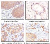 Anti-KRT5 Mouse Monoclonal Antibody