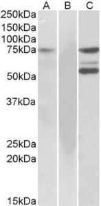 HEK293 lysate (10ug protein in RIPA buffer) overexpressing Human (ITK) with DYKDDDDK tag probed with Anti-ITK Antibody (A83776) (1 µg/ml) in Lane A and probed with Anti-DYKDDDDK Tag Antibody (1/10000) in Lane C