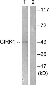 Antibody anti-GIRK1 100 µg