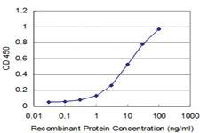 Anti-ROR2 Mouse Monoclonal Antibody [clone: 4E1]