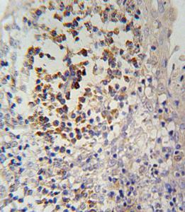 Anti-IL12RB2 Rabbit Polyclonal Antibody