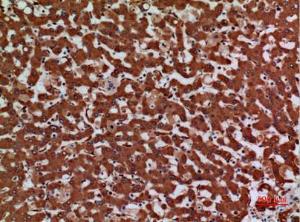 Anti-LAMC2 antibody