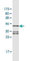 Anti-NR4A2 Mouse Monoclonal Antibody [clone: 4A6]