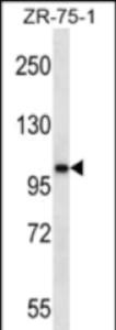 Anti-AR Rabbit Polyclonal Antibody (Biotin)