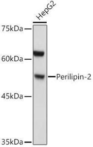 Western blot analysis of extracts of HepG2 cells, using Anti-ADFP Antibody (A9828) at 1:1,000 dilution