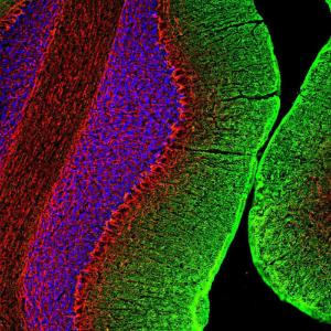 Immunofluorescent analysis of rat cerebellum section stained with Anti-NF-M Antibody (1:2,000 / red) and Anti-GAP43 Antibody (A85393 / 1:2,000 / green)