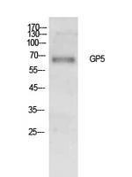 Western blot analysis of extracts from Hela cells using Anti-GP5 Antibody