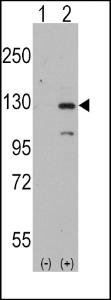 Anti-DAAM1 Rabbit Polyclonal Antibody (Biotin)