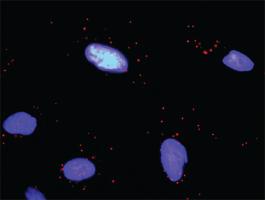 Anti-HDAC2 + HDAC1 Antibody Pair