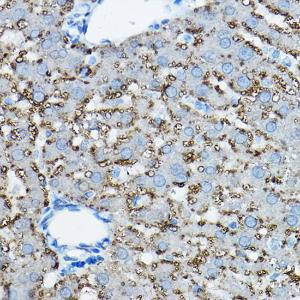 Immunohistochemistry analysis of paraffin-embedded rat liver using Anti-ADFP Antibody (A9828) at a dilution of 1:50 (40X lens). Perform high pressure antigen retrieval with 10 mM citrate buffer pH 6.0 before commencing with IHC staining protocol