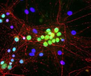 Mixed neuron/glia cultures stained with Anti-NF-M Antibody (red) and Anti-Fox1 Antibody (A85396 / green). The Anti-NF-M Antibody stains axonal, dendritic and perikaryal profiles of neurons cleanly and specifically.