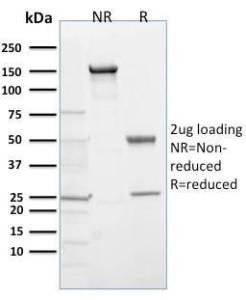 SDS-PAGE analysis of Anti-PHD2 Antibody [366G/76/3] under non-reduced and reduced conditions; showing intact IgG and intact heavy and light chains, respectively. SDS-PAGE analysis confirms the integrity and purity of the Antibody