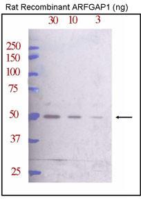 Anti-ARFGAP1 Rabbit Polyclonal Antibody (PE (Phycoerythrin))