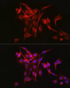 Immunofluorescence analysis of PC-12 cells using Anti-Keap1 Antibody (A309232) at a dilution of 1:100 (40x lens). DAPI was used to stain the cell nuclei (blue).